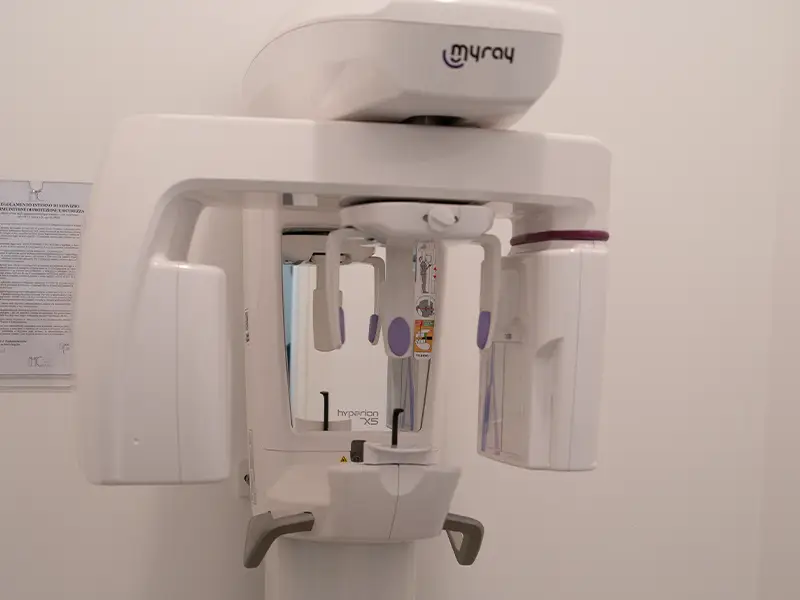 TC dentalscan - Missori