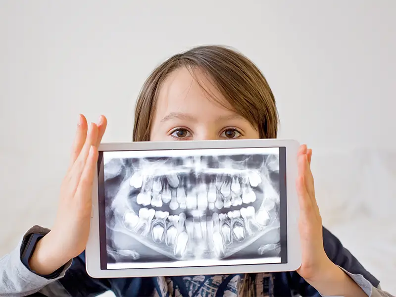 Missori - Odontoiatria Pediatrica Missori - Odontoiatria Pediatrica